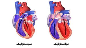 انواع صدای قلب